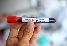 Superaron el Covid-19 en las últimas horas 12.183 colombianos