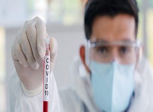 NO SE DEBE BAJAR LA GUARDIA, EL COVID-19 ESTA ACTIVO