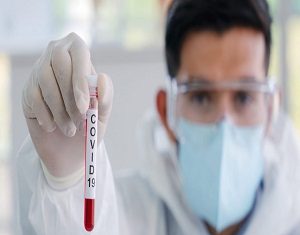 NO SE DEBE BAJAR LA GUARDIA, EL COVID-19 ESTA ACTIVO